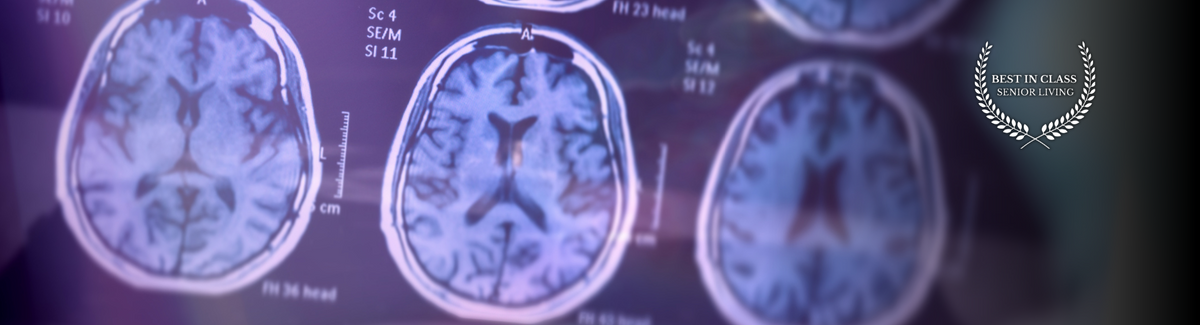  Alzheimers or another form of dementia 